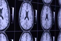Ricerca biomedica: intelligenza collettiva in rete Ricerca biomedica: intelligenza collettiva in rete