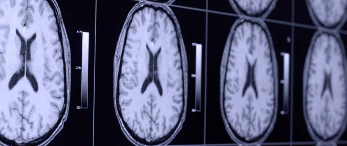 Ricerca biomedica: intelligenza collettiva in rete Ricerca biomedica: intelligenza collettiva in rete